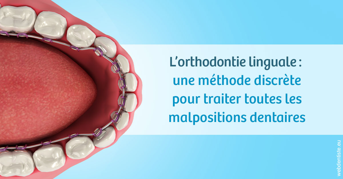 https://selarl-athias-lezmi.chirurgiens-dentistes.fr/L'orthodontie linguale 1