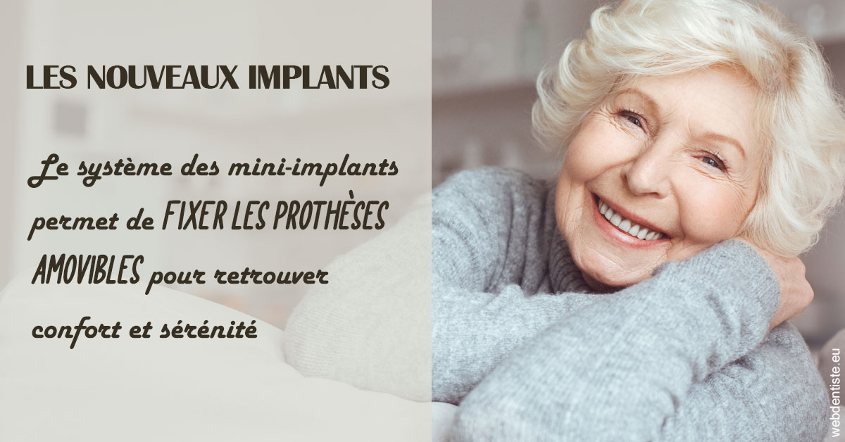 https://selarl-athias-lezmi.chirurgiens-dentistes.fr/Les nouveaux implants 1