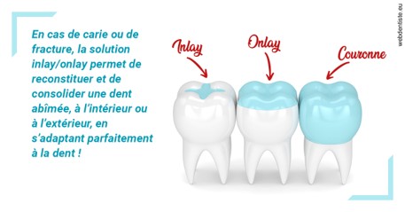 https://selarl-athias-lezmi.chirurgiens-dentistes.fr/L'INLAY ou l'ONLAY