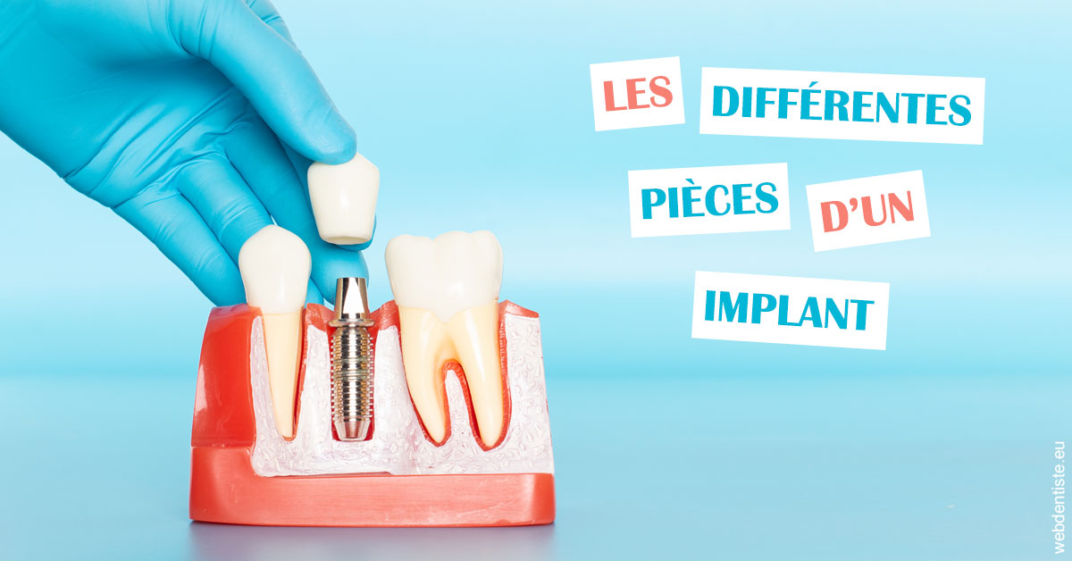 https://selarl-athias-lezmi.chirurgiens-dentistes.fr/Les différentes pièces d’un implant 2