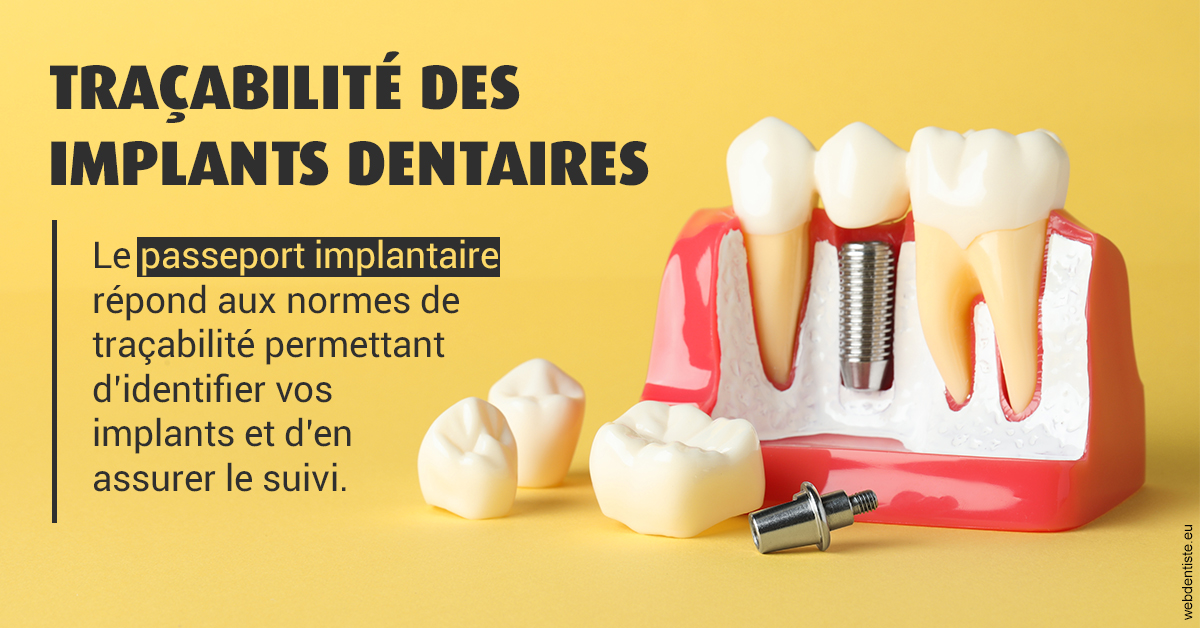 https://selarl-athias-lezmi.chirurgiens-dentistes.fr/T2 2023 - Traçabilité des implants 2