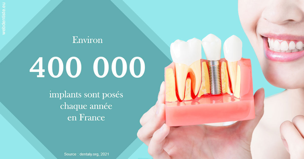https://selarl-athias-lezmi.chirurgiens-dentistes.fr/Pose d'implants en France 2