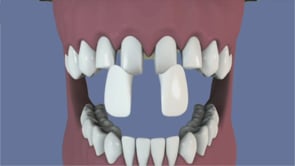 dentisterie-esthe